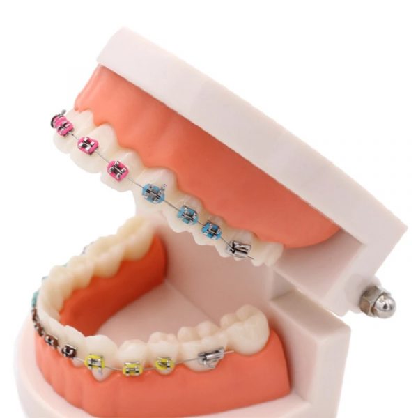 Arcada dental