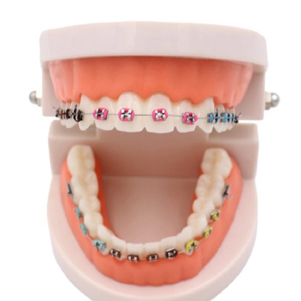 Arcada dental